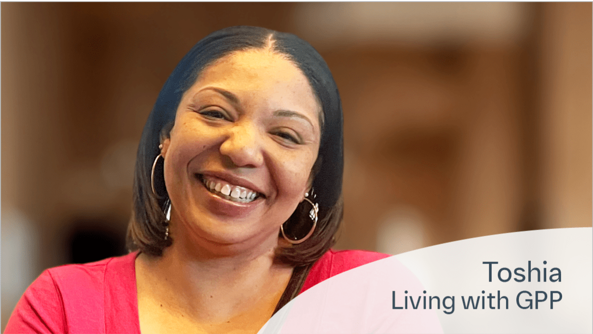Toshia, living with GPP, smiling about overcoming fear